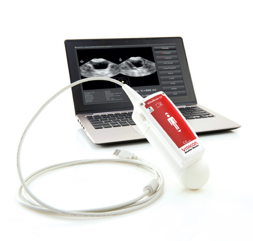 BLADDER SCANNER VITASCAN